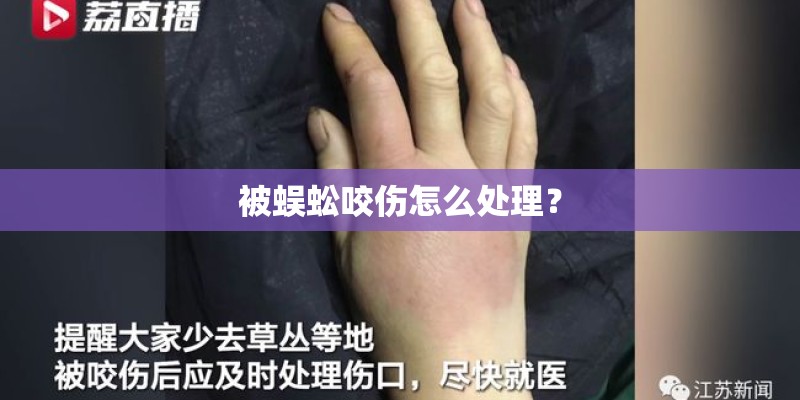 被蜈蚣咬伤怎么处理？
